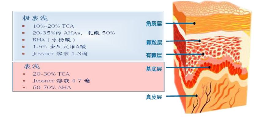 guosuan.jpg
